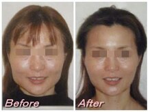 ドクター ヴィーナス/エラがなくなり、輪郭が別人級！