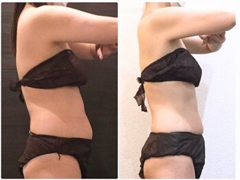 美容整体 ウェリナ 蟹江院/小顔矯正/骨盤矯正/美脚サロン