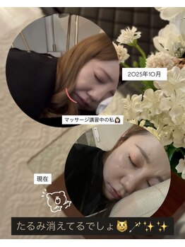 ヨサパーク ブーケ 代々木店(YOSA PARK bouquet)/before/after