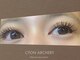 ショーン アーチャリー(CYON ARCHERY)の写真