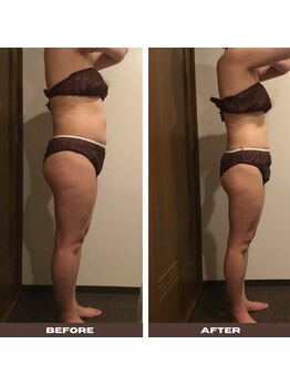 シェリーク 東京店/糖尿家系なので決意