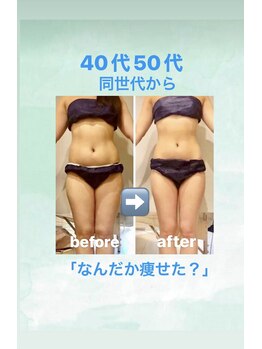 サロン ド プリヴェ(Salon de PRIVE)/40代50代ならではの痩身のススメ