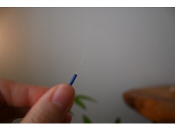 アキュネ 福岡薬院店(acune)/福岡/薬院/美容鍼/美肌