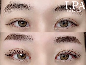 レピア 仙台店/韓国式LEPIA Before&Aｆter