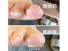 ハジチ(HAZICHI)の雰囲気（大好評！巻爪はお任せください!）