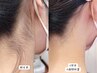 【女性に大人気】うなじ美人に♪セルフ脱毛60分＋『背中・うなじ』お手伝い
