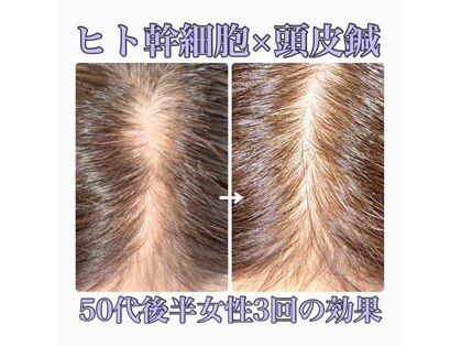 ビプラス(BePlus)の写真