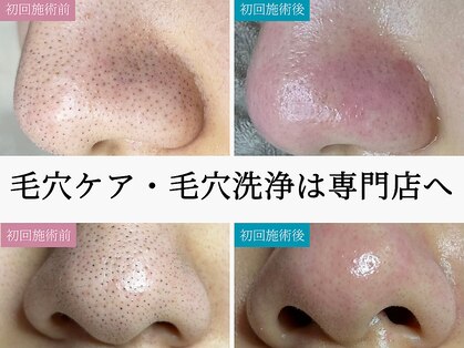 ティーツリー(Tea Tree)の写真