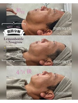 クレビア(CREBIA)/レモンボトル輪郭の変化♪