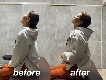 タケダ整体院/肩こり・肩甲骨のこり改善事例