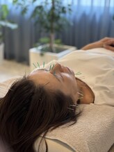 ジョア(joie)/美容鍼施術