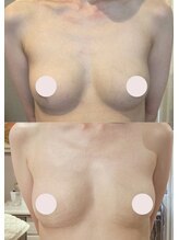 プレジール/バストボリュームアップ