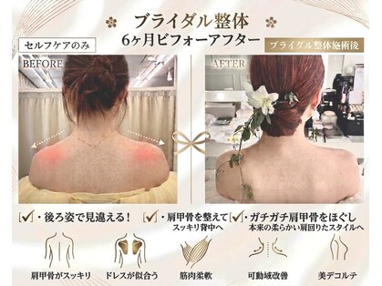 トキワ(TOKIWA)の写真