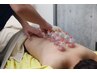 【鍼灸|オーダーメイド】鍼灸・整体 75分枠|美容鍼・鍼・整体を最適設計