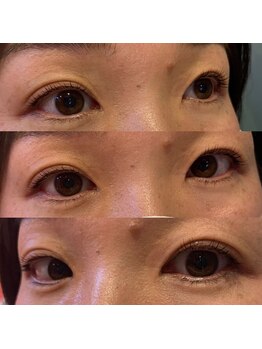 ラス 方南町駅前店(LATH)/12月 まつげパーマ