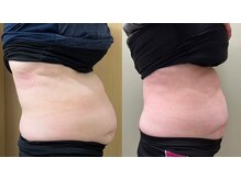 マイティー整骨院 ココア(CoCoa)/ハイブリッドトレーニング