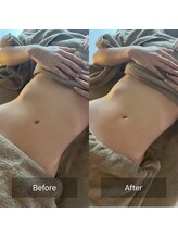 マル(MARU)/アロマでゆったり痩身リンパケア