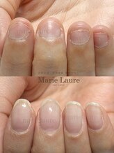 マリーロール 淀屋橋本店(Marie Laure)/自爪育成/深爪矯正/ネイルケア
