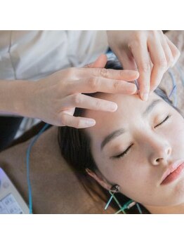 リコア鍼灸接骨 丸ビル(ReCORE鍼灸接骨)/美容鍼