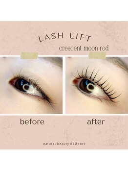 ナチュラル ビューティー ベルポート(natural beauty Bellport)/ラッシュリフトビフォーアフター