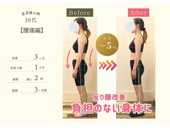 ココア 春日井店(cocoa)/整体&産後骨盤矯正&痩身/春日井