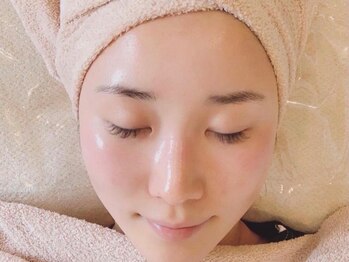 モンシェリの写真/【小顔リンパマッサージ＋美白パックでむくみ・美白ケア】一度で即実感の艶肌は、ツルスベ赤ちゃん肌に。