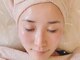 モンシェリの写真/【小顔リンパマッサージ＋美白パックでむくみ・美白ケア】一度で即実感の艶肌は、ツルスベ赤ちゃん肌に。