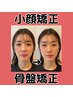 人気No3【小顔矯正+骨盤矯正】シャープなフェイスライン&目元パッチリ!120分