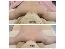 肩こり首こり頭痛の方はリンパマッサージ100分！