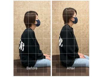 トラスト整体院 小池院/30代/女性/デスクワーク/猫背