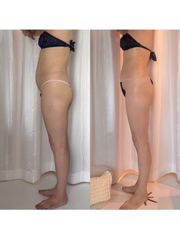 ジョーヌ(JAUNE)/最強痩身！セルゼロ導入！