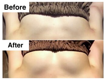 ナトゥーラ チュチュ(natura chuchu)/痩せててもバストアップ可能★