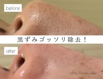 ウェヌ(VENE)