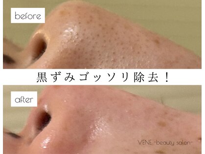 ウェヌ(VENE)の写真