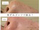 ウェヌ(VENE)の写真
