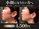 モミン(MOMI.N)の写真/【小顔になりたい方へ】脂肪分解×小顔コルギでフェイスラインすっきり♪むくみ・たるみも集中ケア