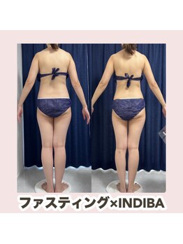 トレス(Tres)/ファスティング×INDIBA