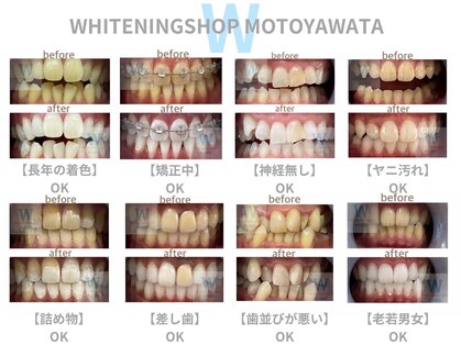 ホワイトニングショップ 本八幡店の写真