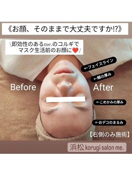 ミードット(me.)/即効性のあるme.のコルギ☆