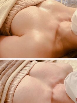 ローズルート(Rose route)の写真/悩んでいた消えなかったシミ改善にも効果◎ぶり返さない納得の結果だから口コミで広まるサロン♪