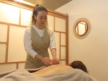 トトノウ(totonou)/背中への刺鍼