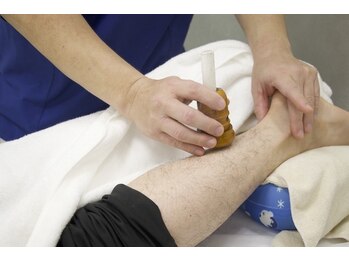 寝屋川かわい鍼灸整骨院/鍼灸で足の疲れやむくみに