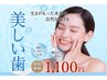 【11月限定】美白ホワイトニング7,700円→1,100円/残り17名