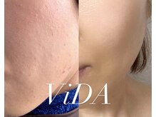 ヴィーダ 渋谷松濤(ViDA)の雰囲気(お肌の根本から肌質改善!結果出し◎)