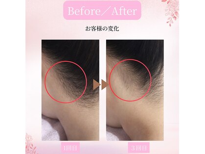 ミラ(Mira)の写真