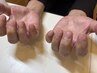 メンズネイルケア(男性)