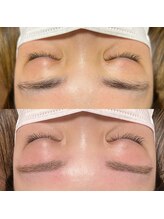 サロンドエピレーション トパーズ(Salon d’ epilation TOPARDS)/眉毛のお手入れ