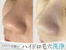 8月限定【今SNSで話題のハイドロ毛穴洗浄】+ピーリングケアで毛穴汚れを洗浄