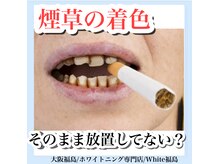 ホワイトニングサロン ホワイト(WHITE)/セルフホワイトニング/大阪/福島