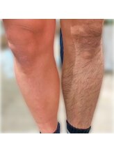 トーチ 船橋店(TORCH)/こんなに違う!!